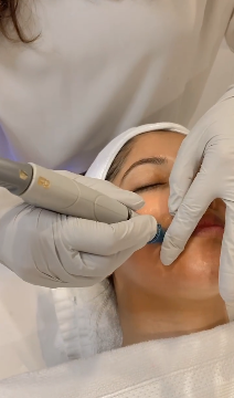 Hydra-Medi-Facial Treatment