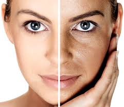 Pigmentation solutions